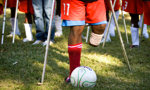 lower half of a soccer player with a below-the-knee amputation behind a soccer ball